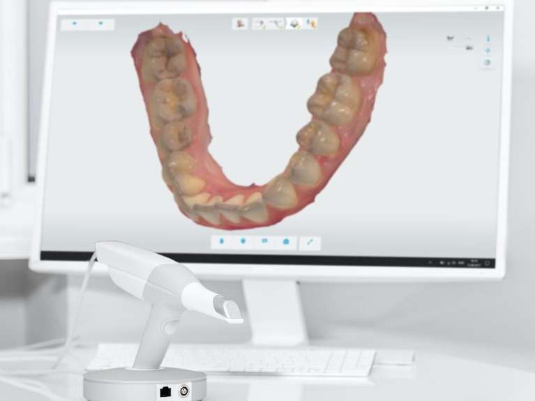 3D digital dental scan displayed on a monitor with intraoral scanner technology at Sutton Dentistry in Ocala, FL.