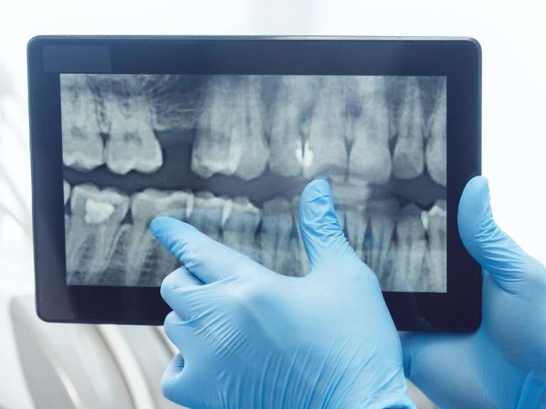 Dentist reviewing digital dental X-rays on a tablet during a diagnostic exam at Sutton Dentistry in Ocala, FL.